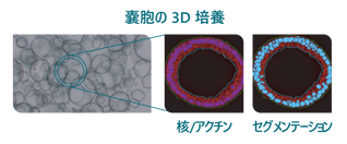 cyst-in-3D-culture-01